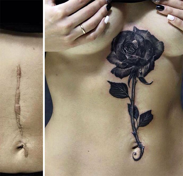 cicatrices marcas tatuajes 12