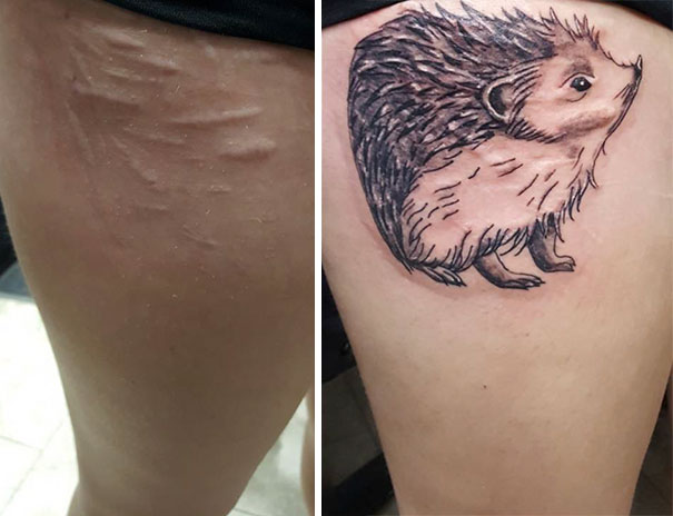 cicatrices marcas tatuajes 14