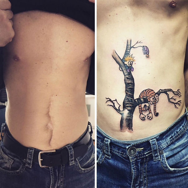 cicatrices marcas tatuajes 15