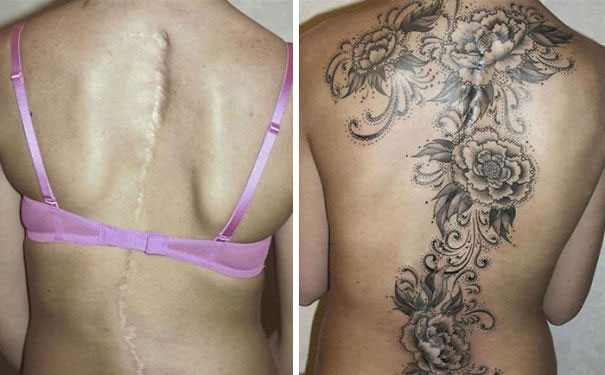 cicatrices marcas tatuajes 20