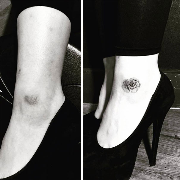 cicatrices marcas tatuajes 21