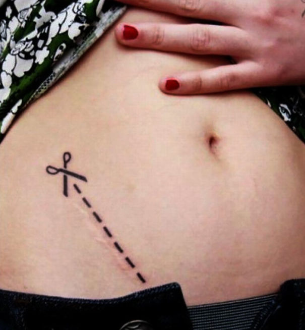 cicatrices marcas tatuajes 22