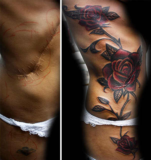cicatrices marcas tatuajes 28