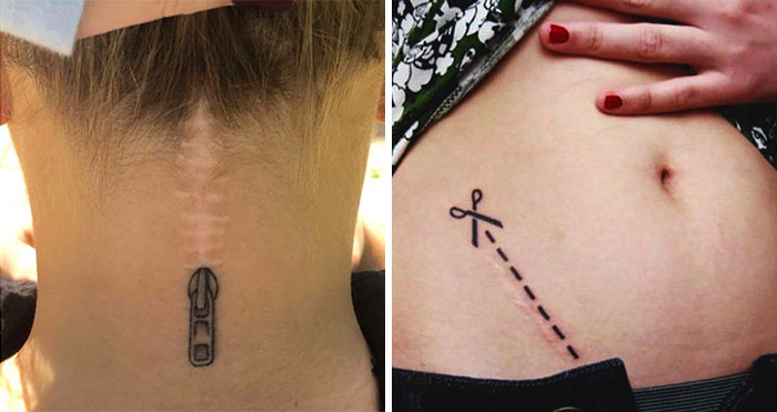 cicatrices marcas tatuajes 30
