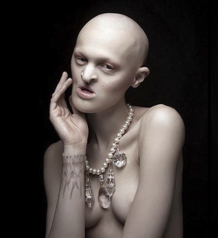 Melanie Gaydos displasia ectodermica desorden genetico 15