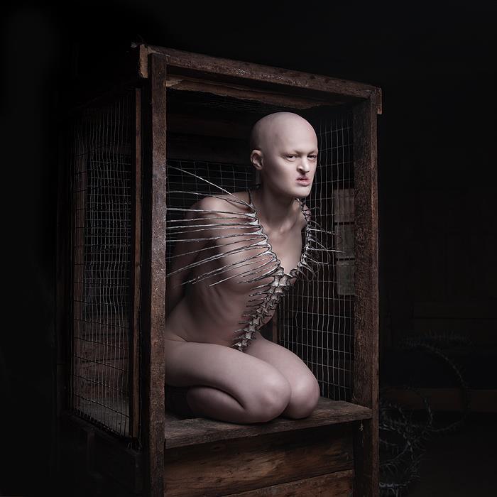 Melanie Gaydos displasia ectodermica desorden genetico 3