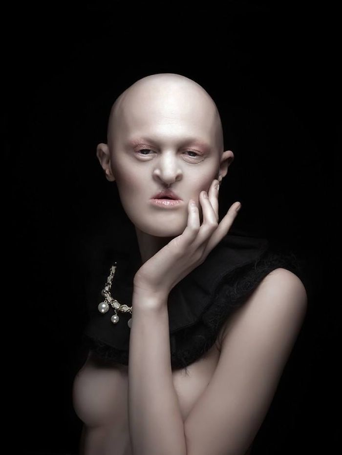 Melanie Gaydos displasia ectodermica desorden genetico 7