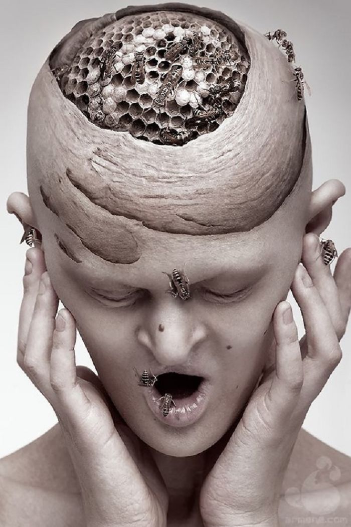 Melanie Gaydos displasia ectodermica desorden genetico 8