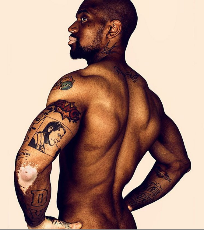 Retrato fotográfico de persona que padecen vitiligo, Brock Elbank