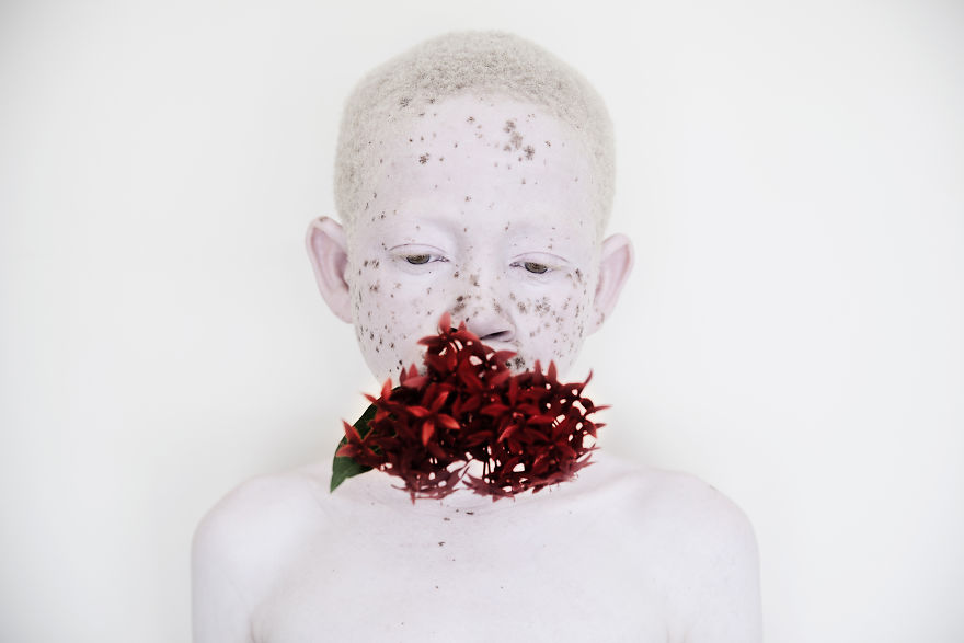 Marinka Masseus albinos