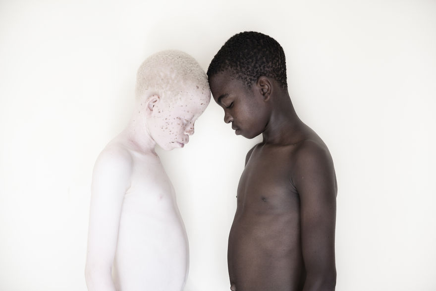 Marinka Masseus albinos