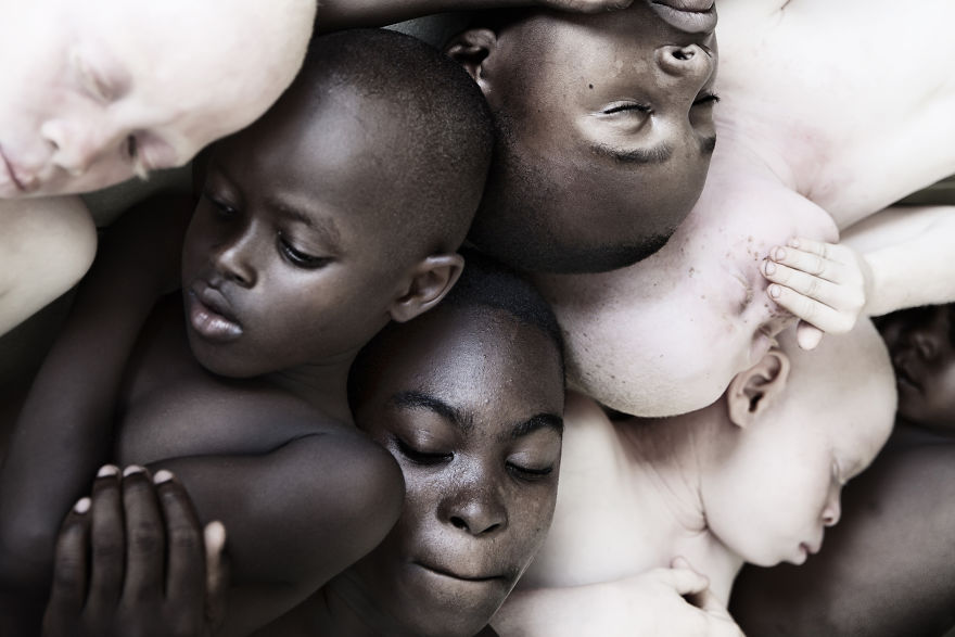 Marinka Masseus albinos