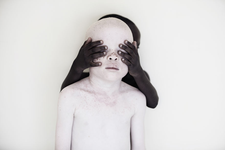Marinka Masseus albinos