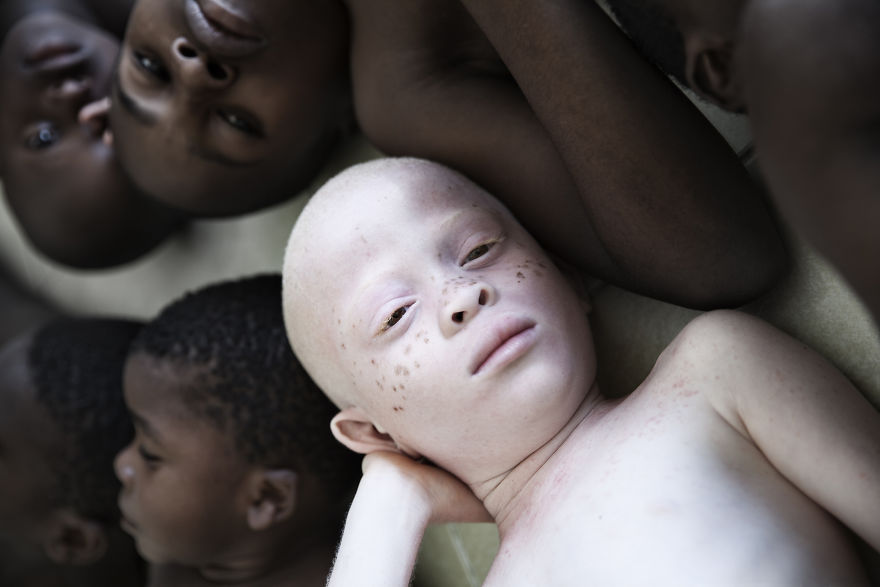 Marinka Masseus albinos