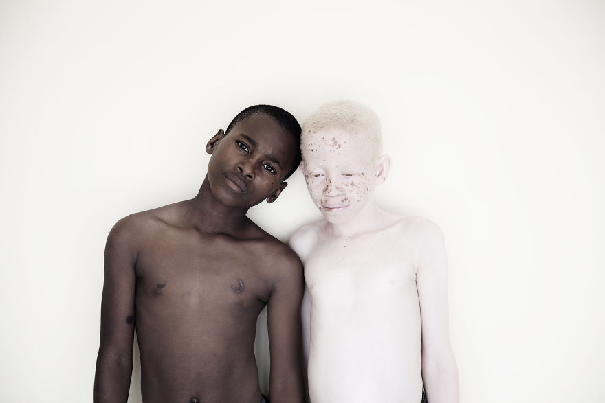Marinka Masseus albinos