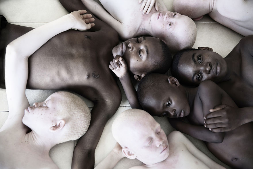 Marinka Masseus albinos