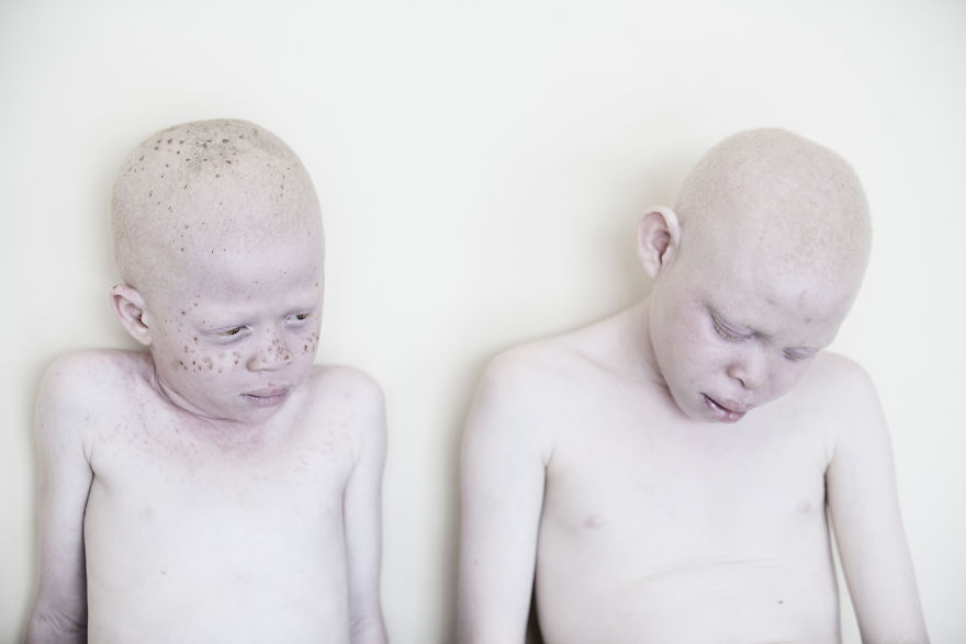 Marinka Masseus albinos