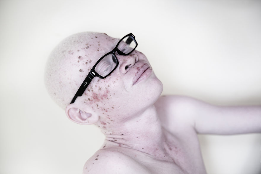 Marinka Masseus albinos