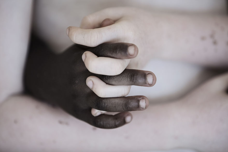 Marinka Masseus albinos
