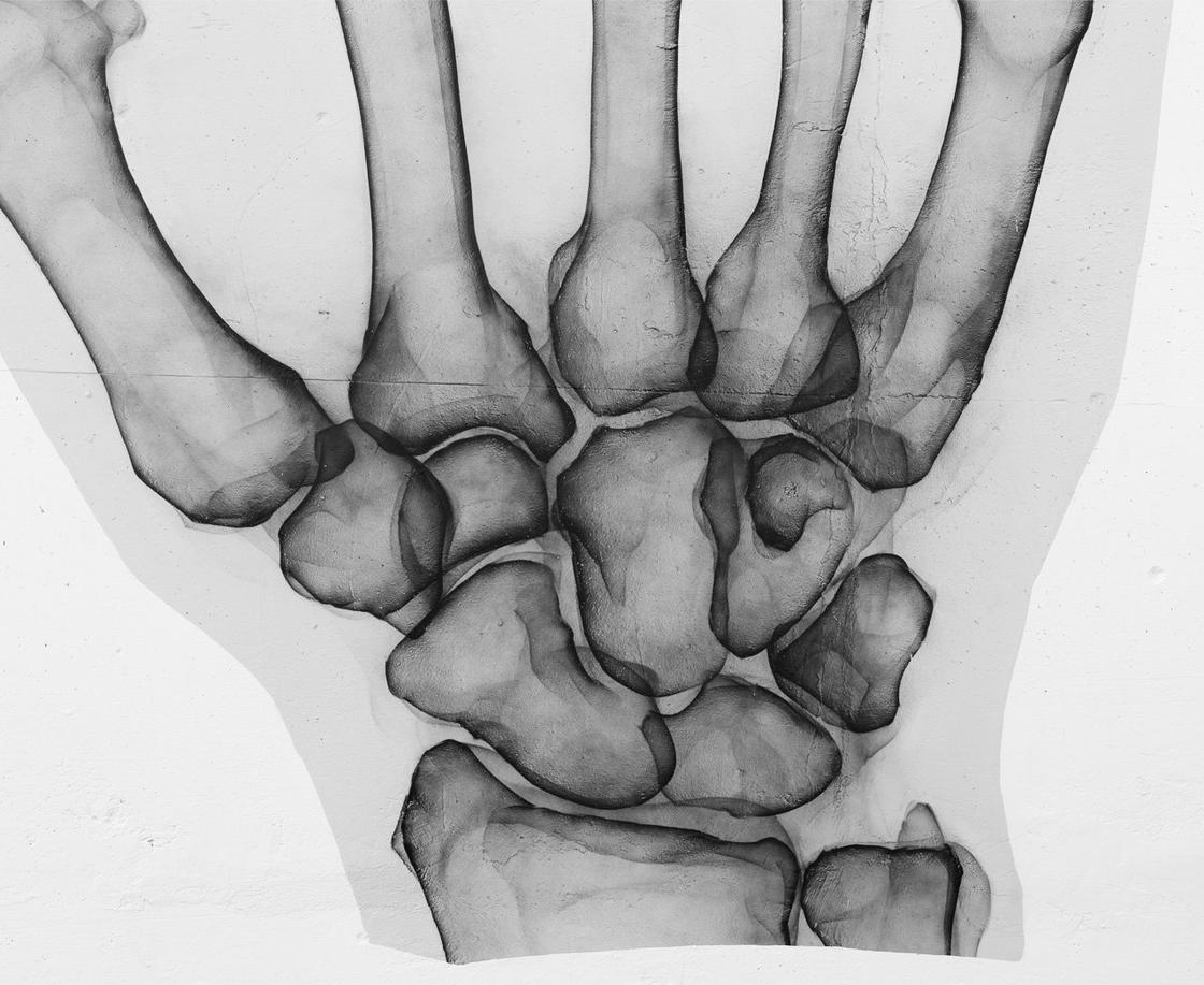 x ray street art shok. Cultura Inquieta 20