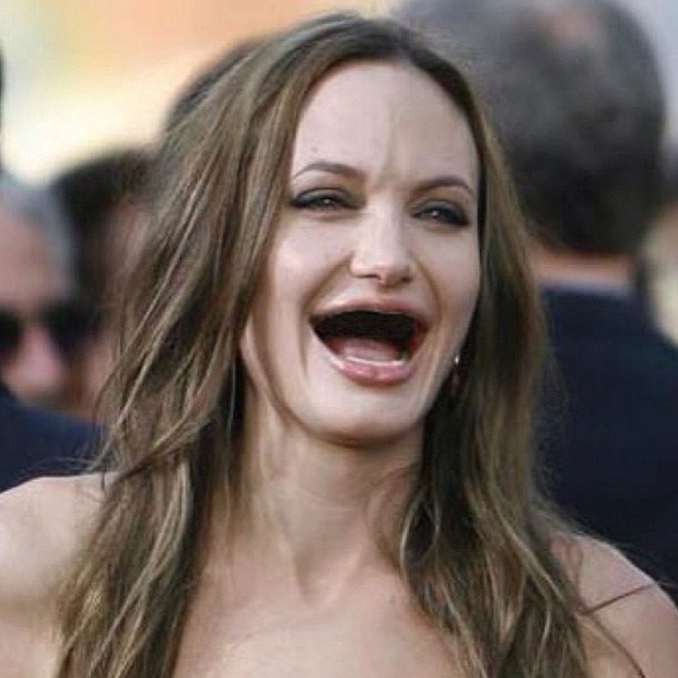 famosos sin dientes 2