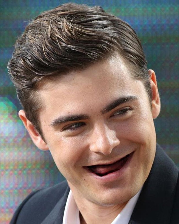 famosos sin dientes 5