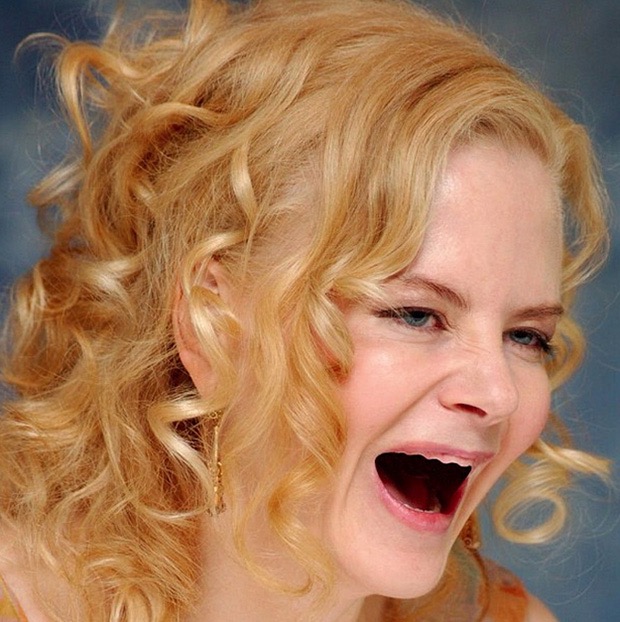 famosos sin dientes 6
