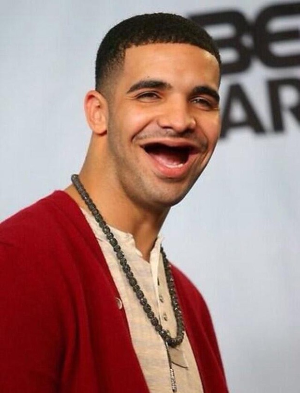 famosos sin dientes 9