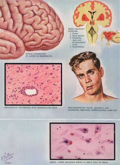 ilustraciones medicas Netter 01