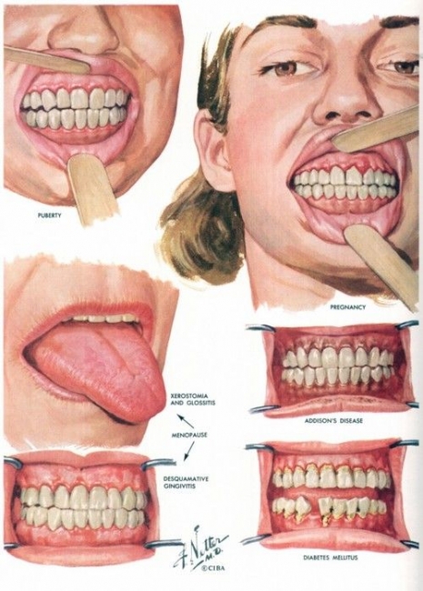 ilustraciones medicas Netter 04