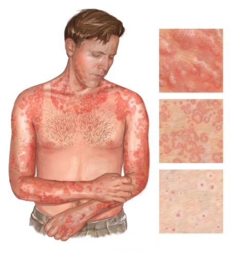 ilustraciones medicas Netter 07