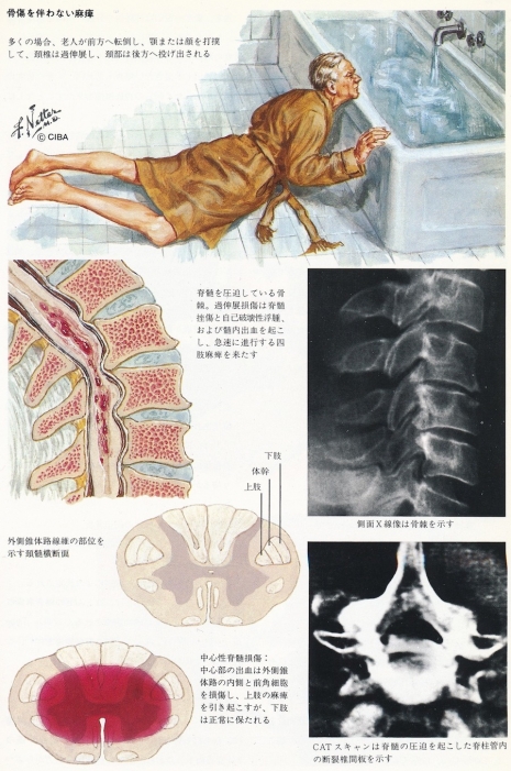 ilustraciones medicas Netter 08