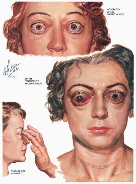 ilustraciones medicas Netter 09