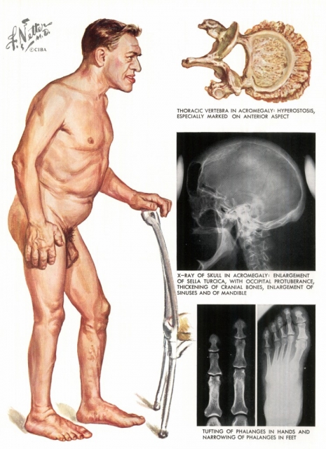 ilustraciones medicas Netter 10