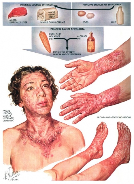 ilustraciones medicas Netter 12