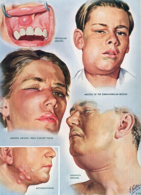 ilustraciones medicas Netter 13