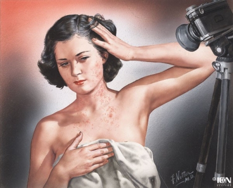 ilustraciones medicas Netter 14