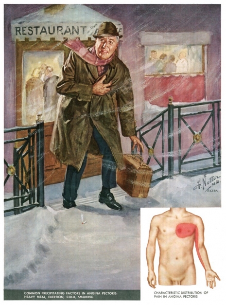 ilustraciones medicas Netter 17