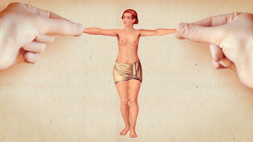 Supervenus Frederic Doazan