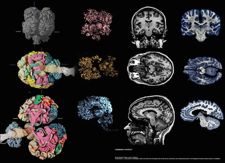 cerebro ganchillo 03