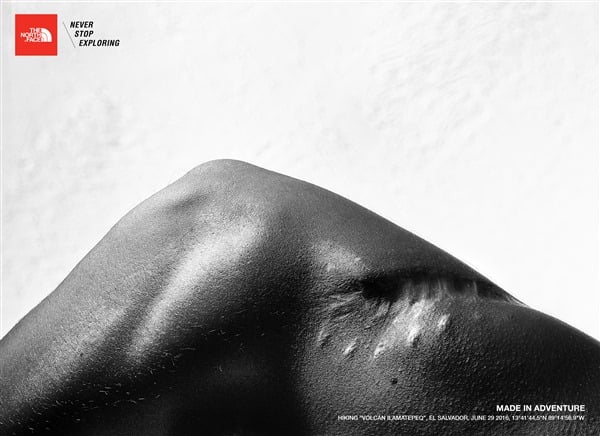 Una campaña de The North Face hace un homenaje a las cicatrices del deporte