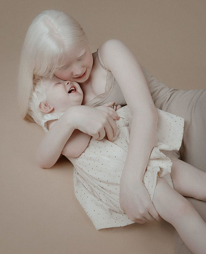 albino hermanas