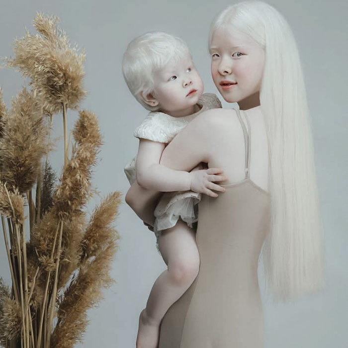 albino hermanas 1