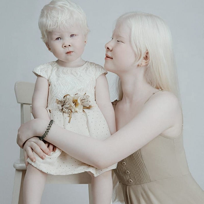 albino hermanas 10