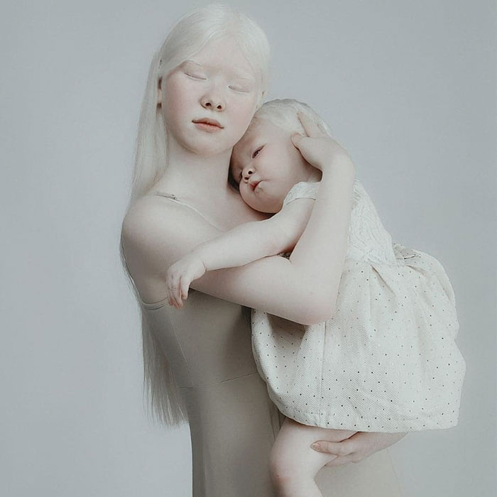 albino hermanas 11