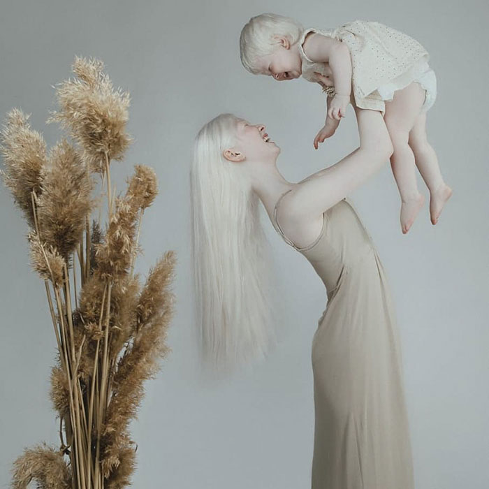 albino hermanas 12