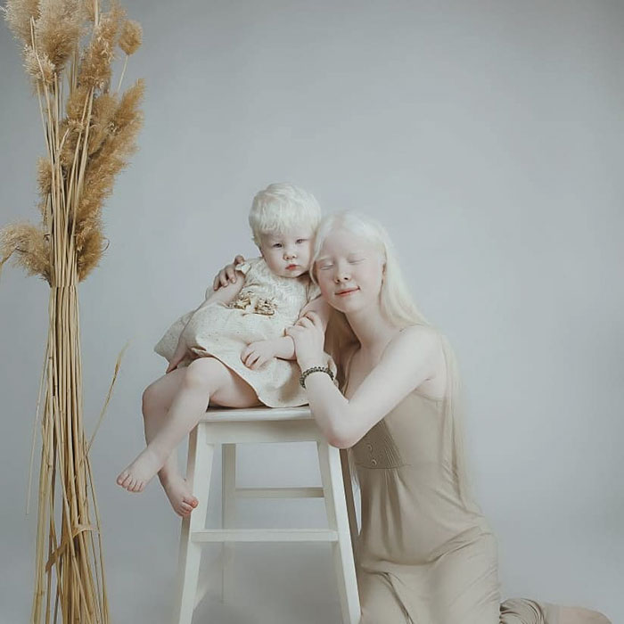 albino hermanas 14