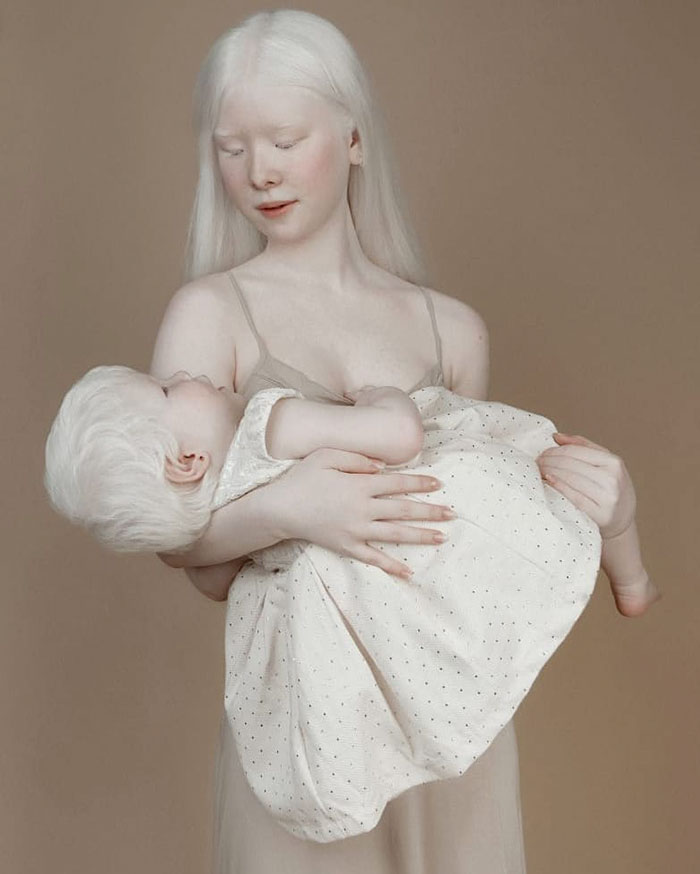 albino hermanas 16