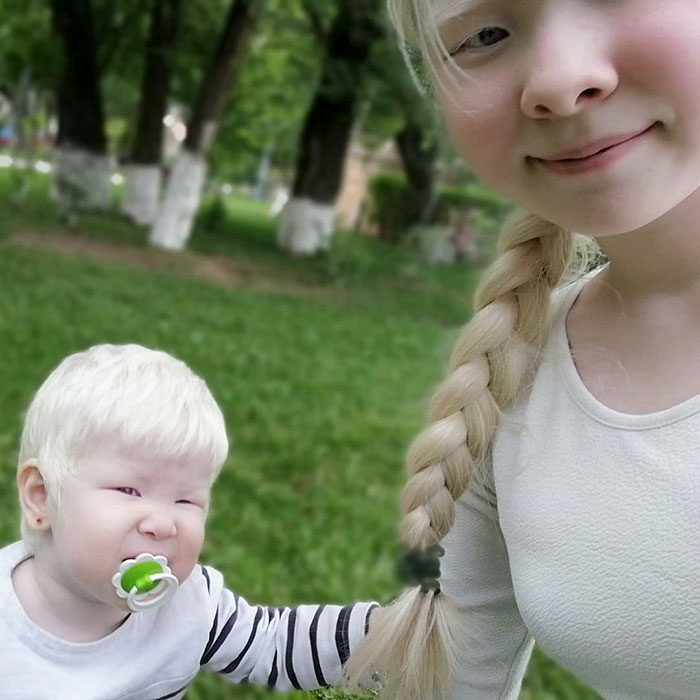 albino hermanas 17