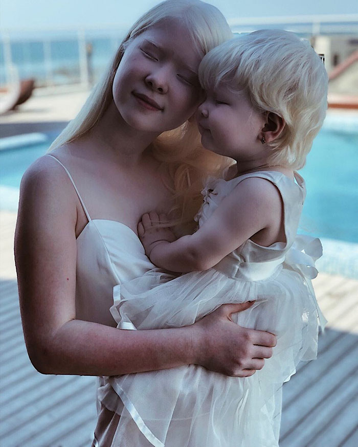 albino hermanas 18